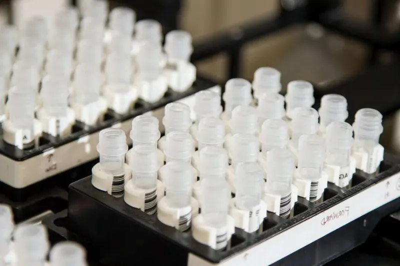 Skillnaden mellan autosomalt DNA och Y-kromosom-DNA-testning